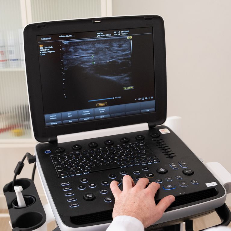 Estudio de la pisada Gijón